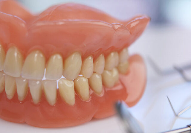 Complete-Denture1